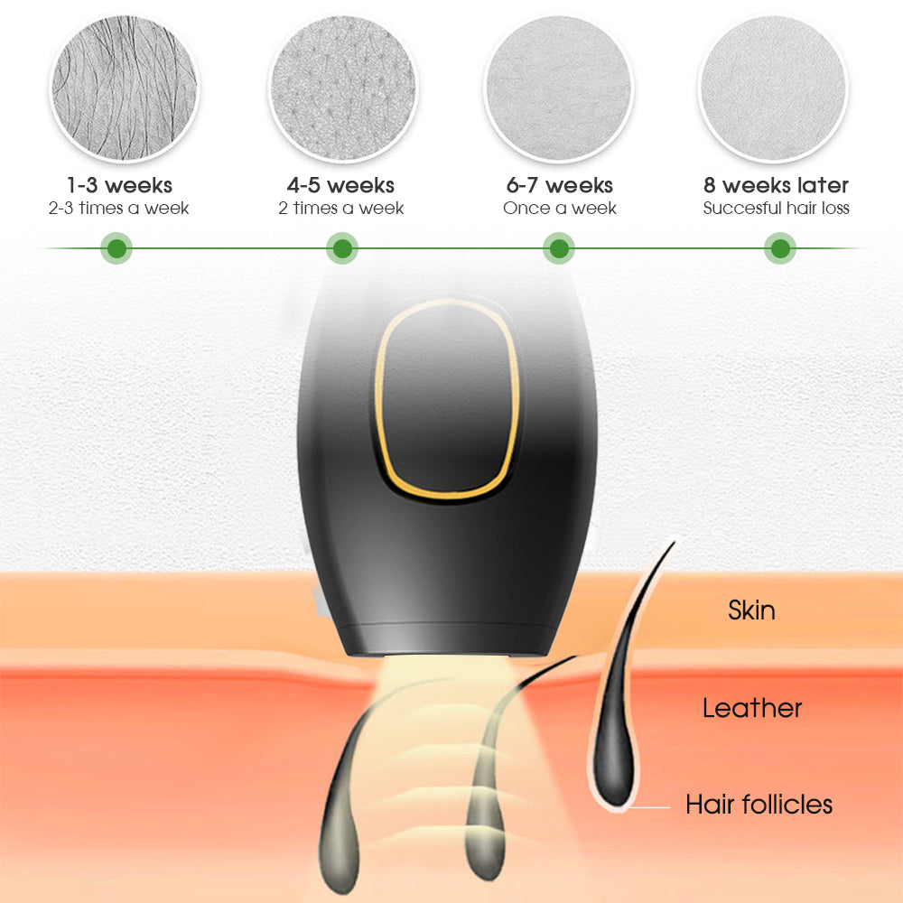 REMUOVA™ SmoothSkin IPL Pro